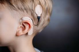 Cochlear patent example