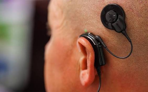 Cochlear production management image